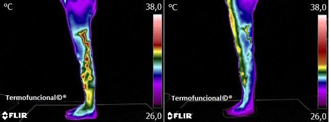 Monitoramento de condição Termofuncional