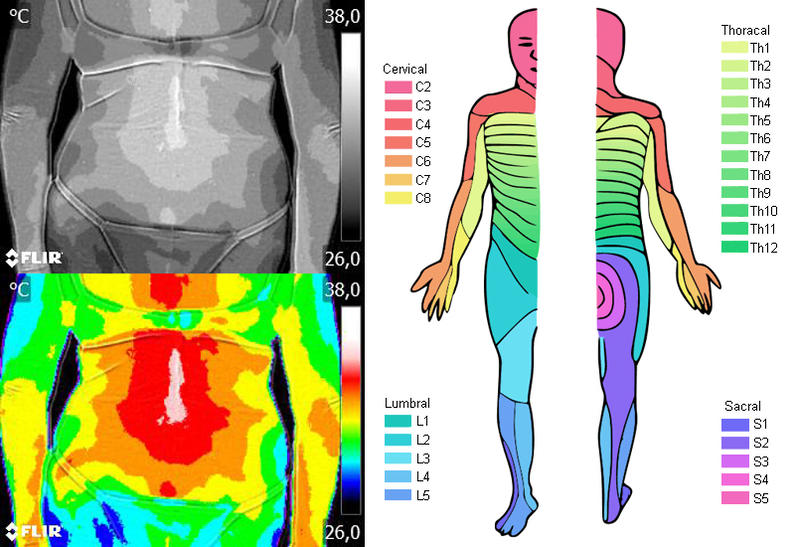 Localização da dor em tempo real – Técnica Termofuncional