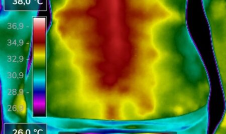 Curiosidades práticas da termografia infravermelha na fisioterapia 3